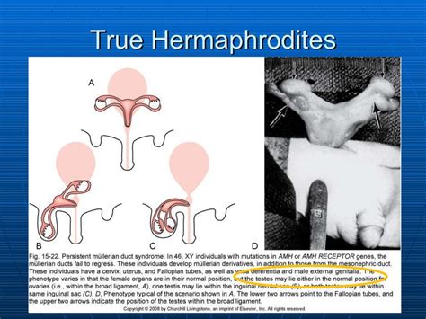 Hermaphrodite Tube 